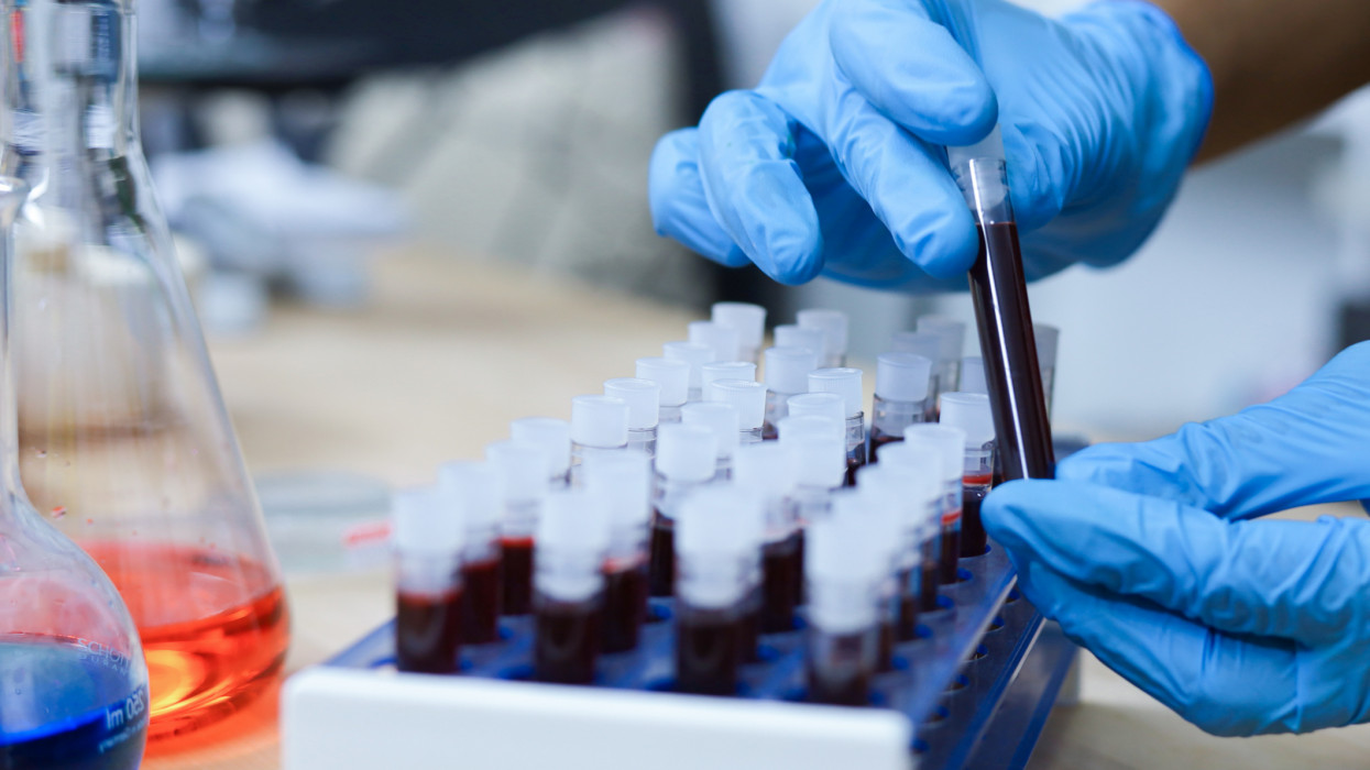 Durva, mennyi pénzt kereshetsz a véreddel: most emelték meg a kifizetéseket